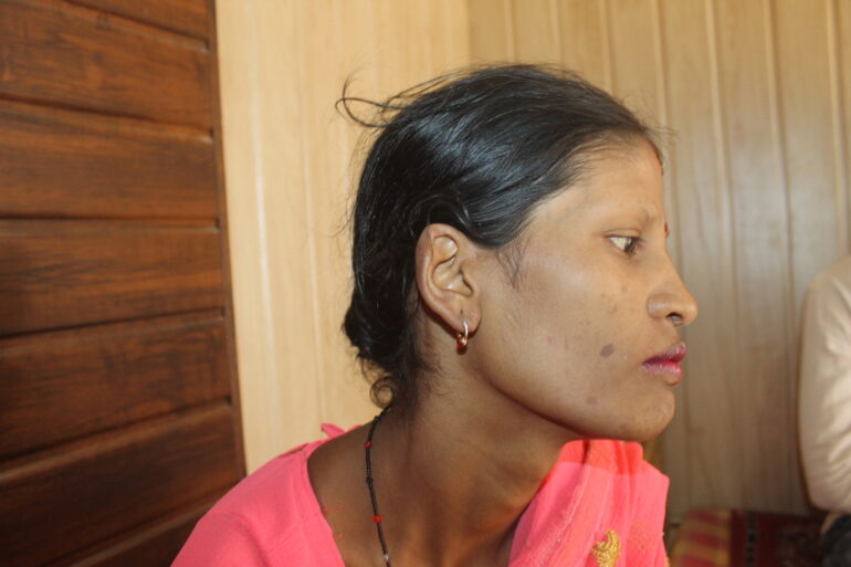 Management of Cutaneous Tuberculosis: A Case Study from a Rural Clinic in Balrampur