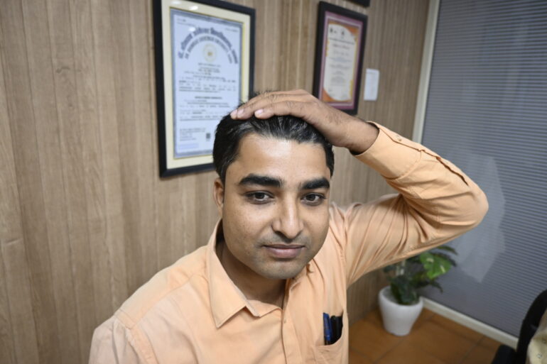 Successful Treatment of Verruca Plana (Flat Warts) – A Patient from Madhubani, Bihar