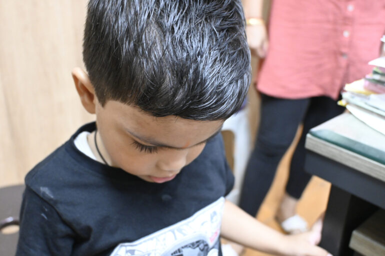 Cure of Scalp and body Psoriasis in child with Classical Homeopathy