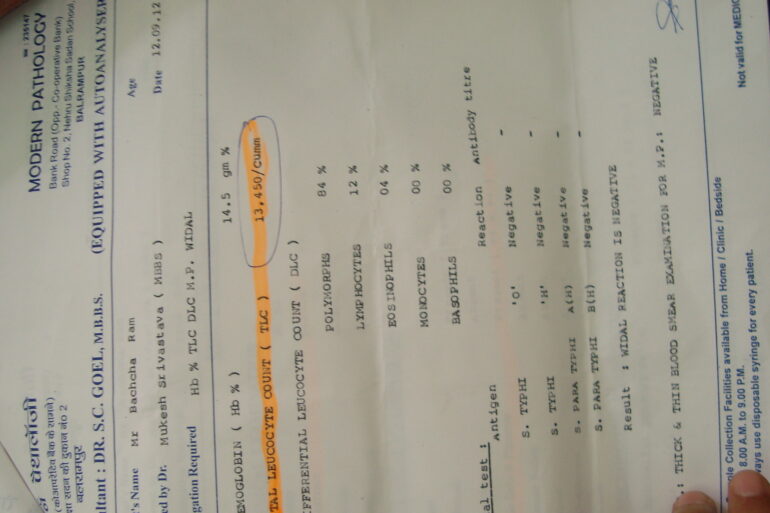 Jaundice: High Serum Bilirubin 44.7 totally cured with homeopathy