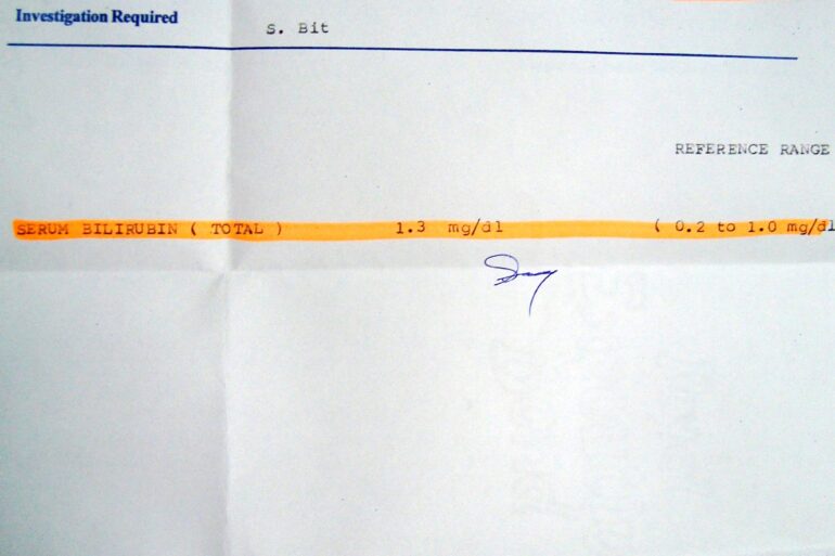 Jaundice: High Serum Bilirubin 44.7 totally cured with homeopathy