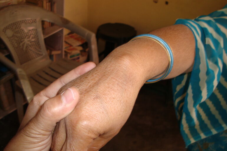 A case of Ganglion in an Old Lady from Balrampur