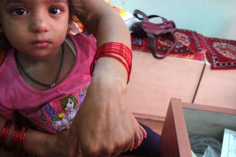 A case of Ganglion at Wrist resolved with Homeopathy