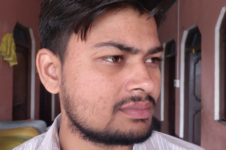 Flat warts for 7 years and Acne Vulgaris got cured in a patient from Ghaziabad