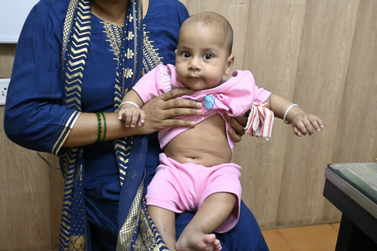 Recovery from Hirschsprung’s Disease without Surgery – A case from Lucknow
