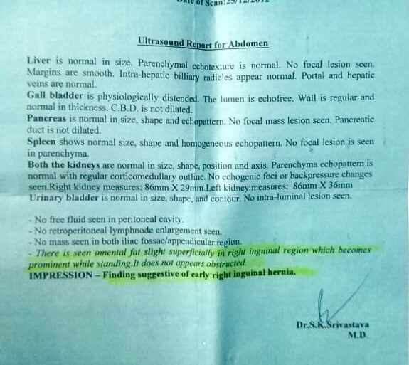 Case of Inguinal Hernia Got Cured