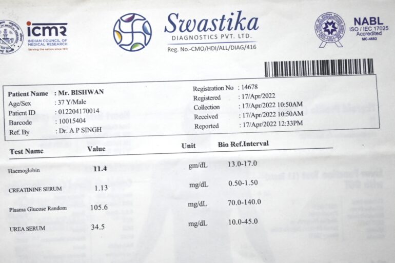 Chyluria Milky Urine – Relief from Day 1