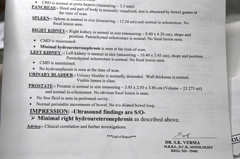 Chyluria Milky Urine – Relief from Day 1