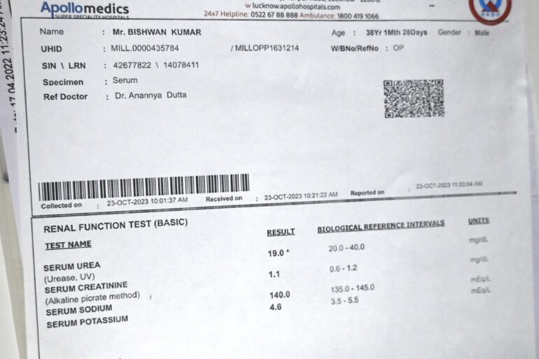 Chyluria Milky Urine – Relief from Day 1