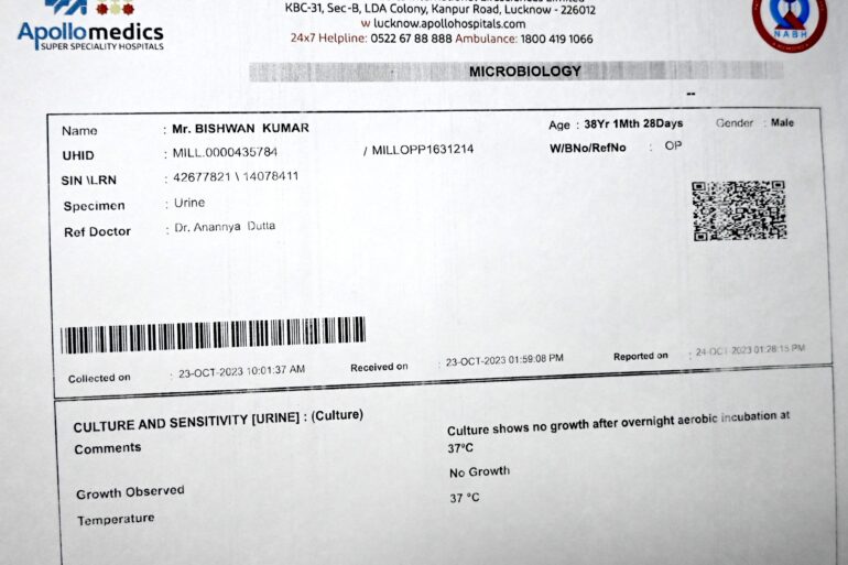 Chyluria Milky Urine – Relief from Day 1