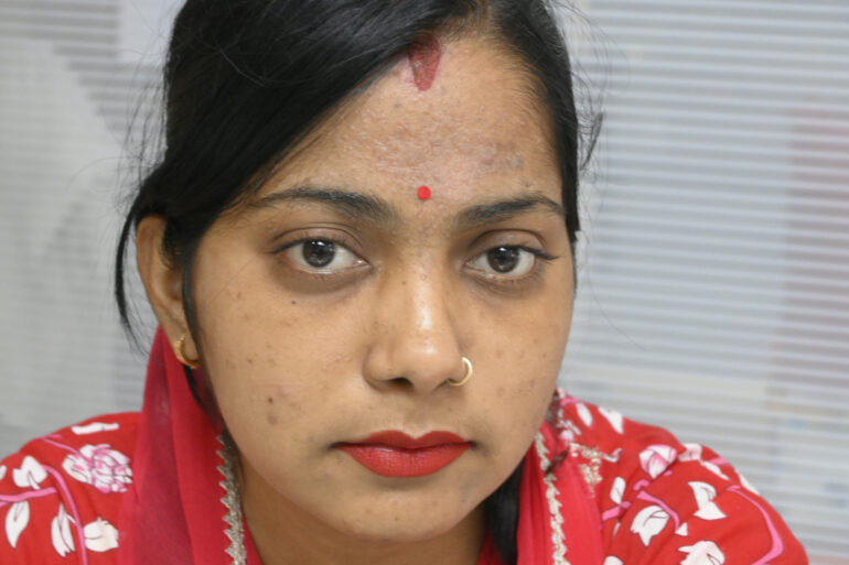 Amazing cure of Flat Warts or Verruca Plana – Case from Varanasi