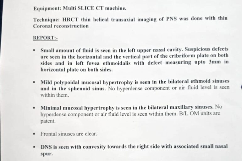Quick recovery in 3 days- Case of CSF Rhinorrhea from Patiala