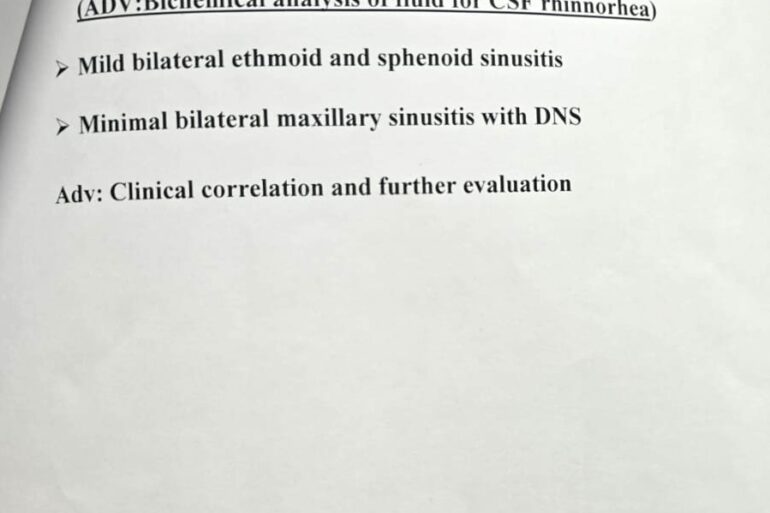 Quick recovery in 3 days- Case of CSF Rhinorrhea from Patiala