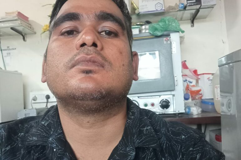 Warts for 1 Years and Chronic Allergic Rhinitis got cured in 10 Days !!!!!