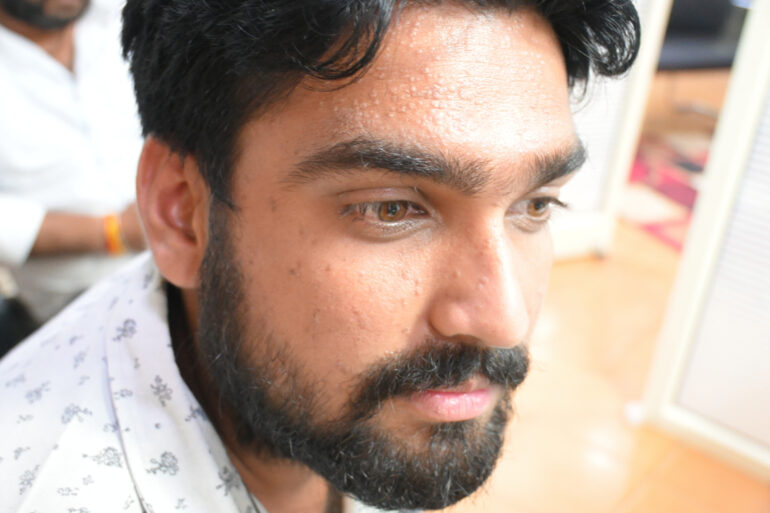 Successful Treatment of Flat Warts via Energy Transmission Case from Gonda