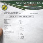 Successful Management of Severe Chyluria and Proteinuria via Medicine Energy Transmission