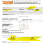 Excellent recovery in Case of Ankylosing Spondylitis – HLA B 27 positive Case