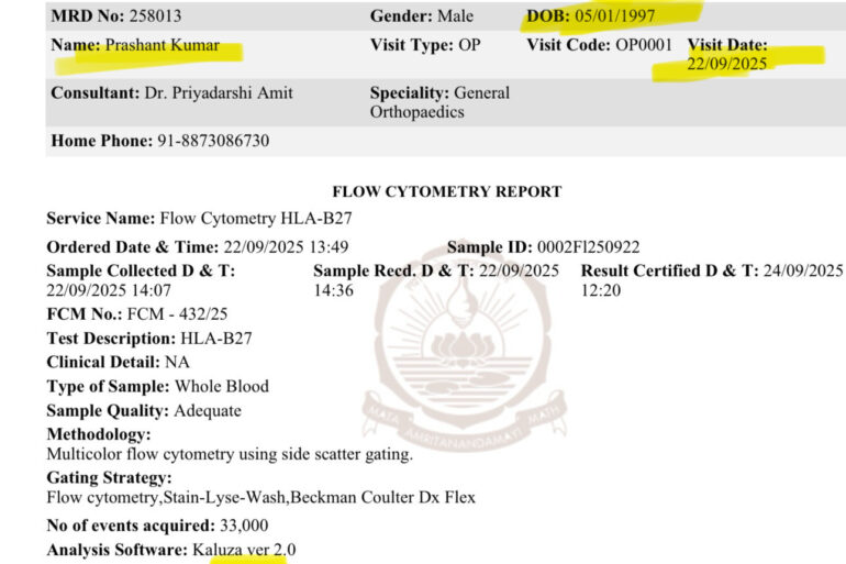 Excellent recovery in Case of Ankylosing Spondylitis – HLA B 27 positive Case