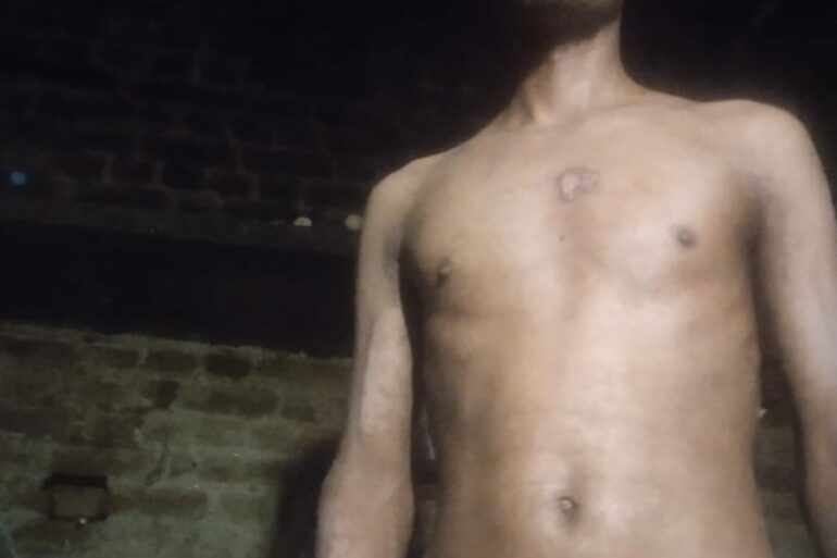 Wonderful Improvement in Horrible skin condition