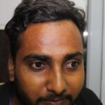 A case of Flat warts or Veruca Plana- case from Agra