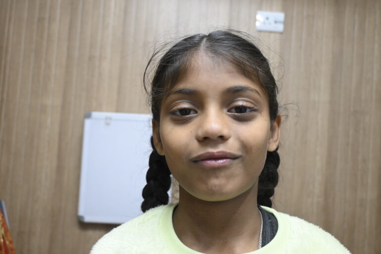 Flat warts for 4 years cured quickly with Homeopathy A case from Unnao