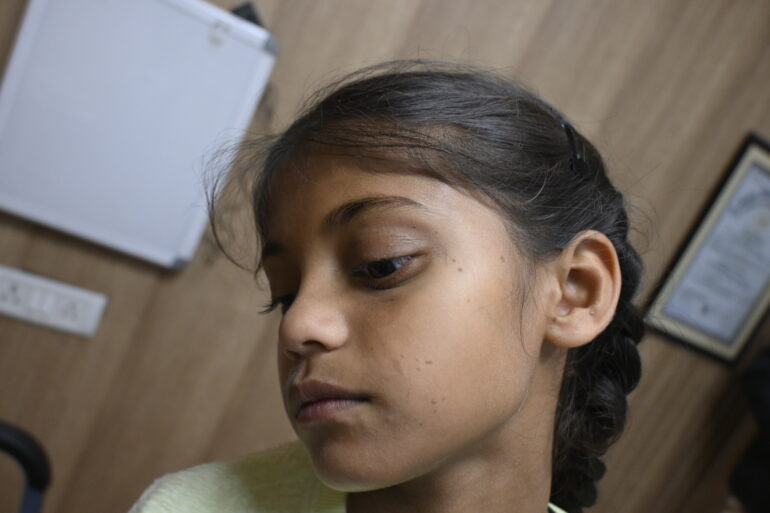 Flat warts for 4 years cured quickly with Homeopathy A case from Unnao