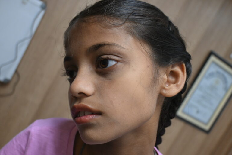 Flat warts for 4 years cured quickly with Homeopathy A case from Unnao