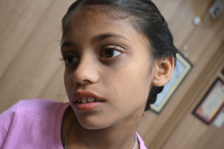 Flat warts for 4 years cured quickly with Homeopathy A case from Unnao