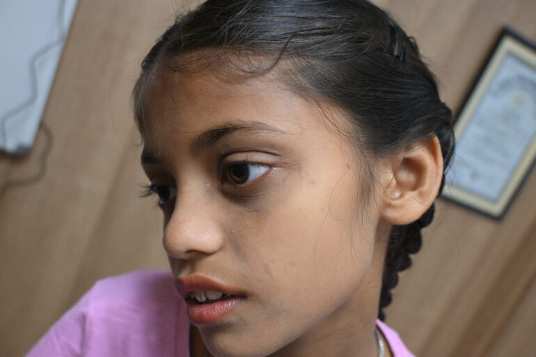 Flat warts for 4 years cured quickly with Homeopathy A case from Unnao