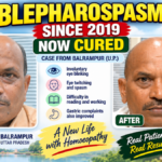 Blepharospasm Since 2019: A Remarkable Case from Balrampur