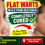 Facial Warts in a 5-Year-Old Child – Online Treatment from Bijnor