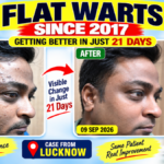 WARTS SINCE 2017 GETTING BETTER IN 21 DAYS- AMZING RECOVERY