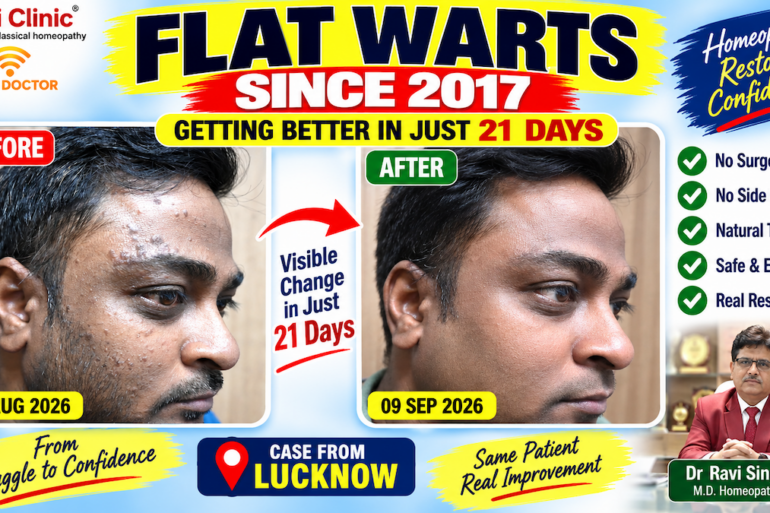WARTS SINCE 2017 GETTING BETTER IN 21 DAYS- AMZING RECOVERY