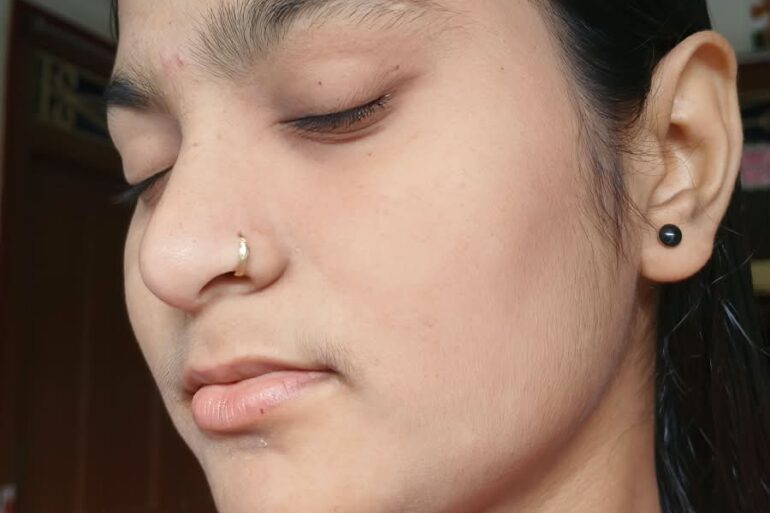 Paramedic Recovers from 4-Year Flat Warts in 14 Days via Medicinre transmission