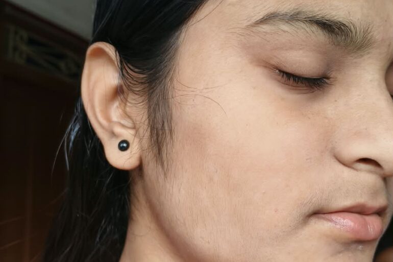 Paramedic Recovers from 4-Year Flat Warts in 14 Days via Medicinre transmission
