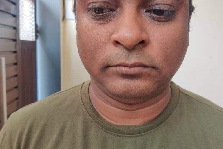 WARTS SINCE 2017 GETTING BETTER IN 21 DAYS- AMZING RECOVERY